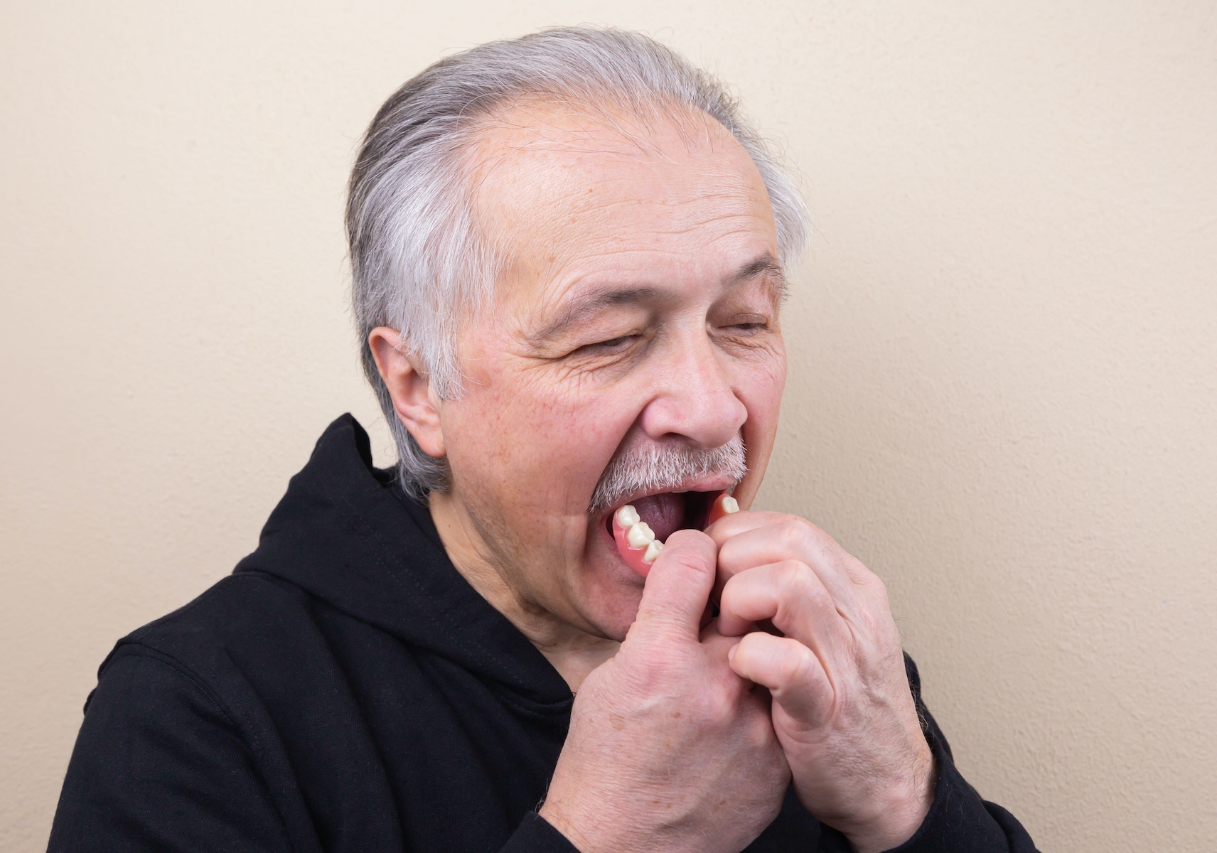 Zahnprothese Einsetzen